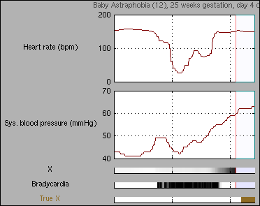 Screenshot of Matlab demo