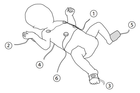 Diagram of neonatal sensors