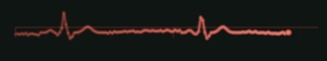 ECG monitor demo