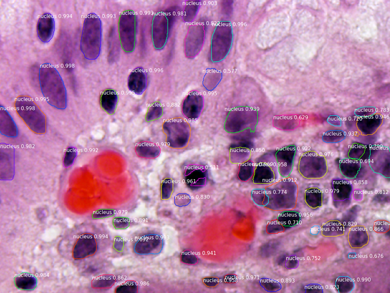 Nucleus Segmentation