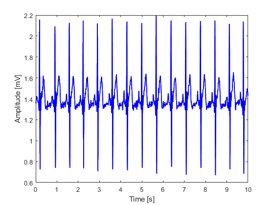 GitHub - juanbernalr/ECG_database: Consolidated database of lead-I ECG ...