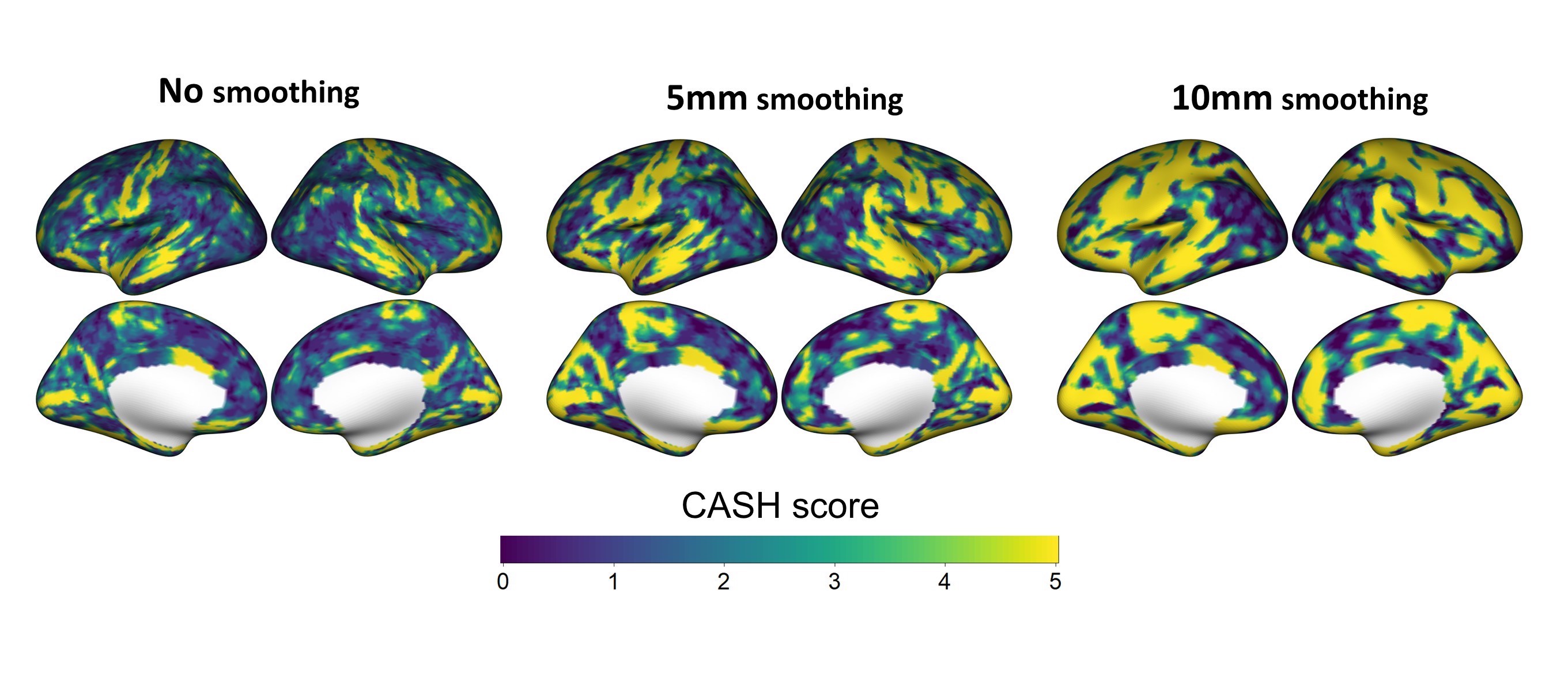 CASH score brain map