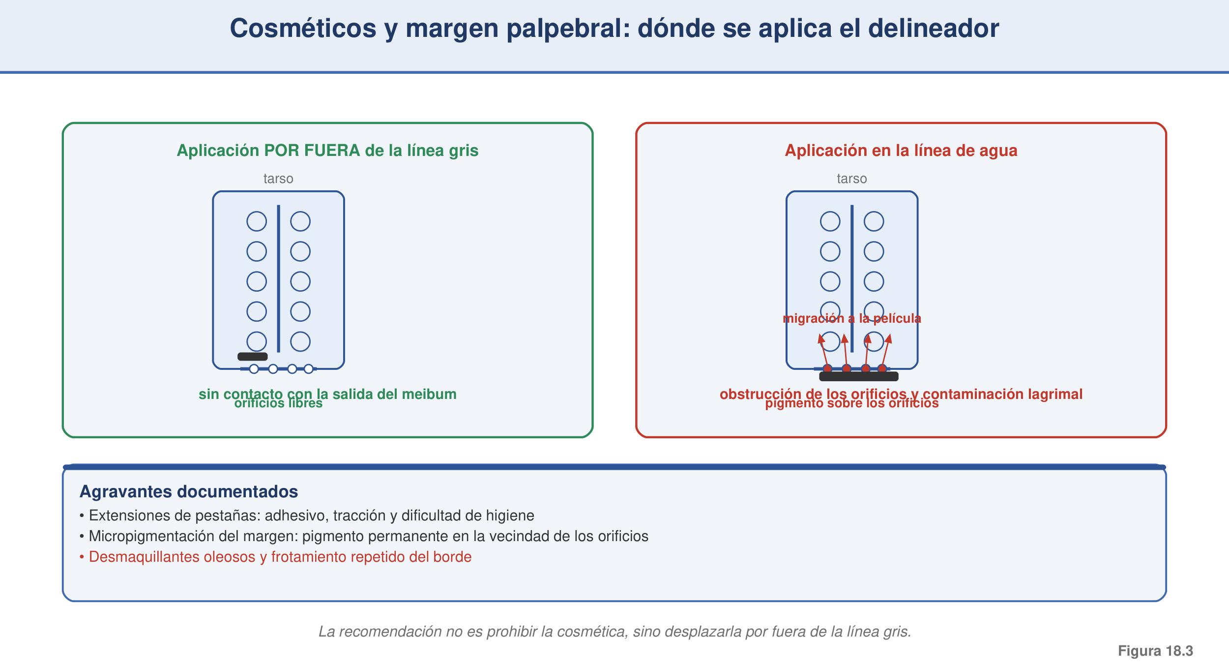 Figura 18.3 — Cosméticos y margen palpebral