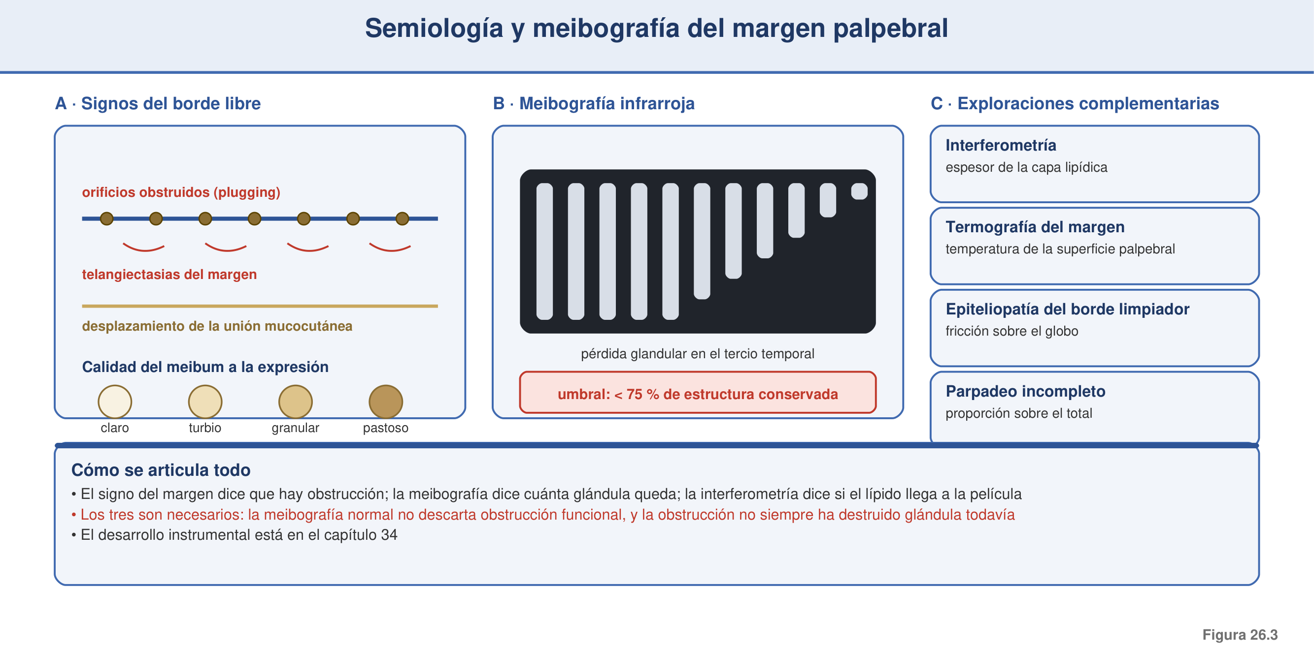 Figura 26.3 — Semiología y meibografía del margen palpebral en DGM