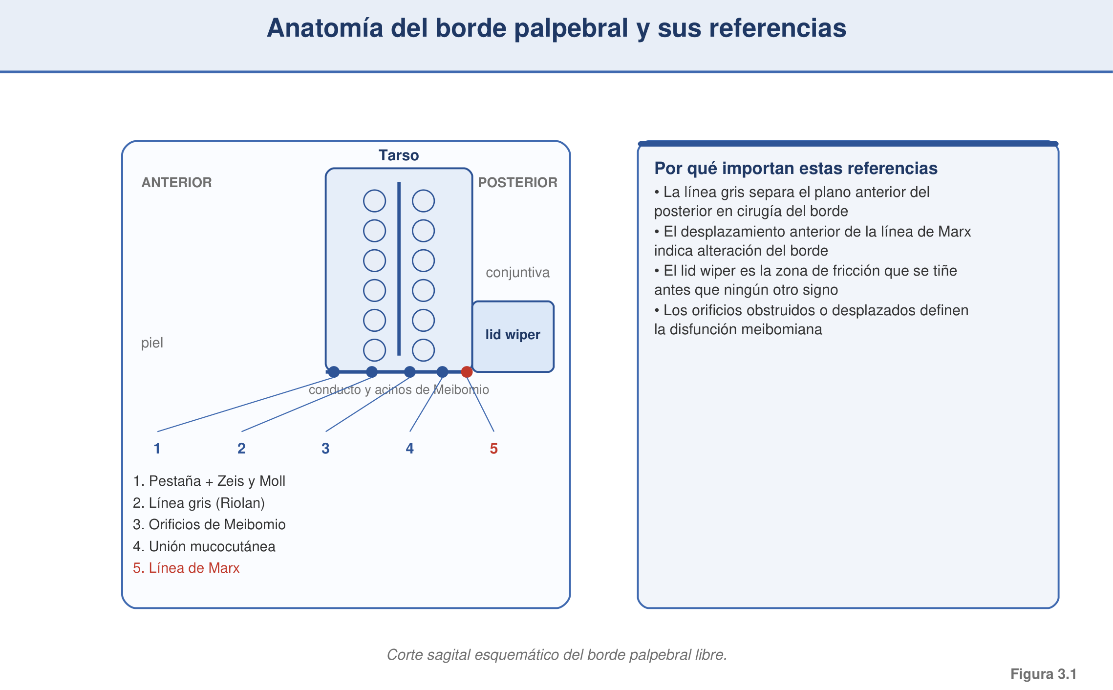 Figura 3.1 — Anatomía del borde palpebral y sus referencias