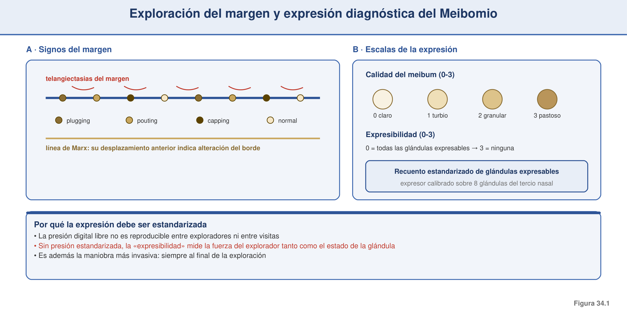 Figura 34.1 — Exploración del margen y expresión diagnóstica del Meibomio