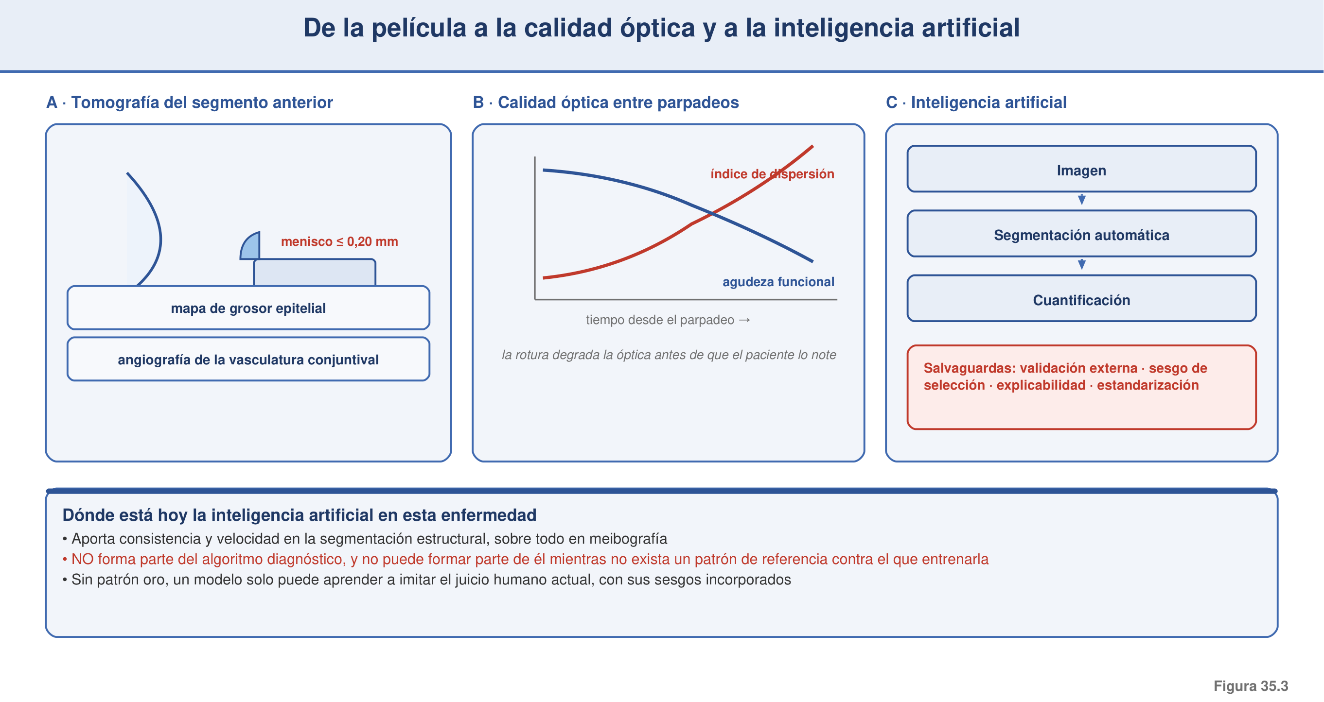 Figura 35.3 — Del film a la calidad óptica y a la IA