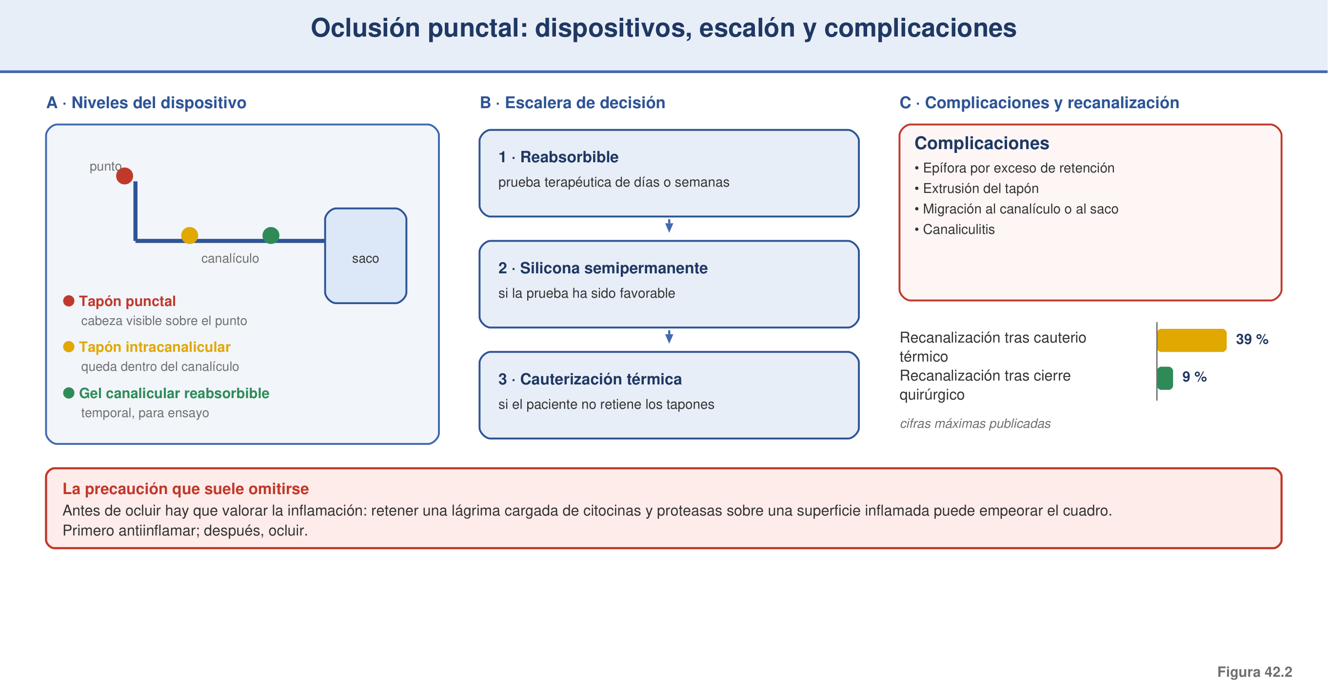 Figura 42.2 — Oclusión punctal: dispositivos, escalón y complicaciones