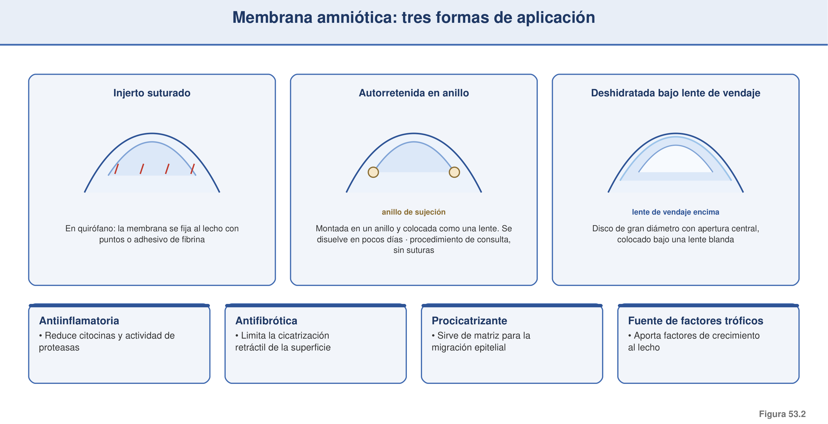 Figura 53.2 — Membrana amniótica: formas de aplicación