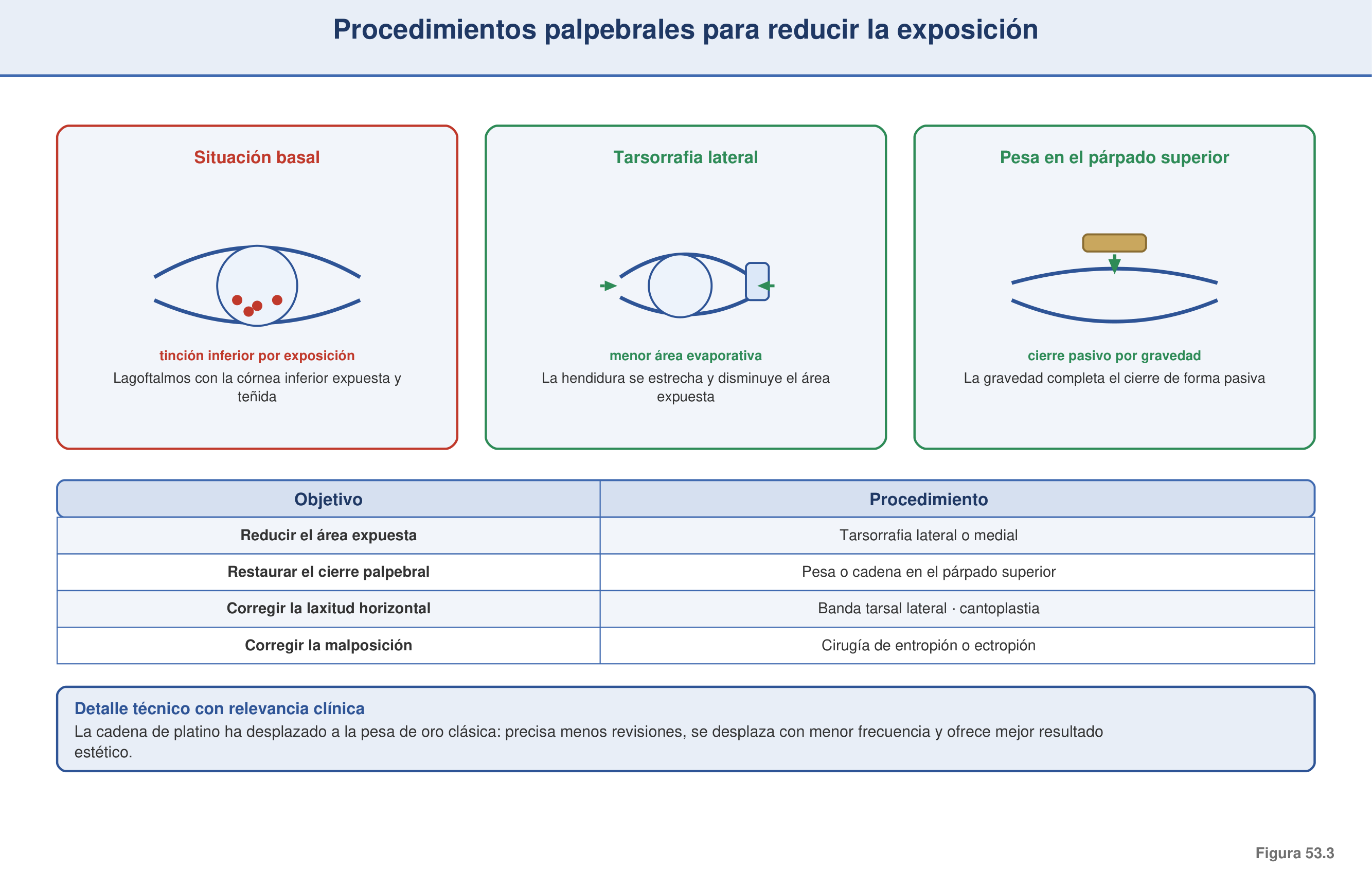 Figura 53.3 — Procedimientos palpebrales para reducir la exposición