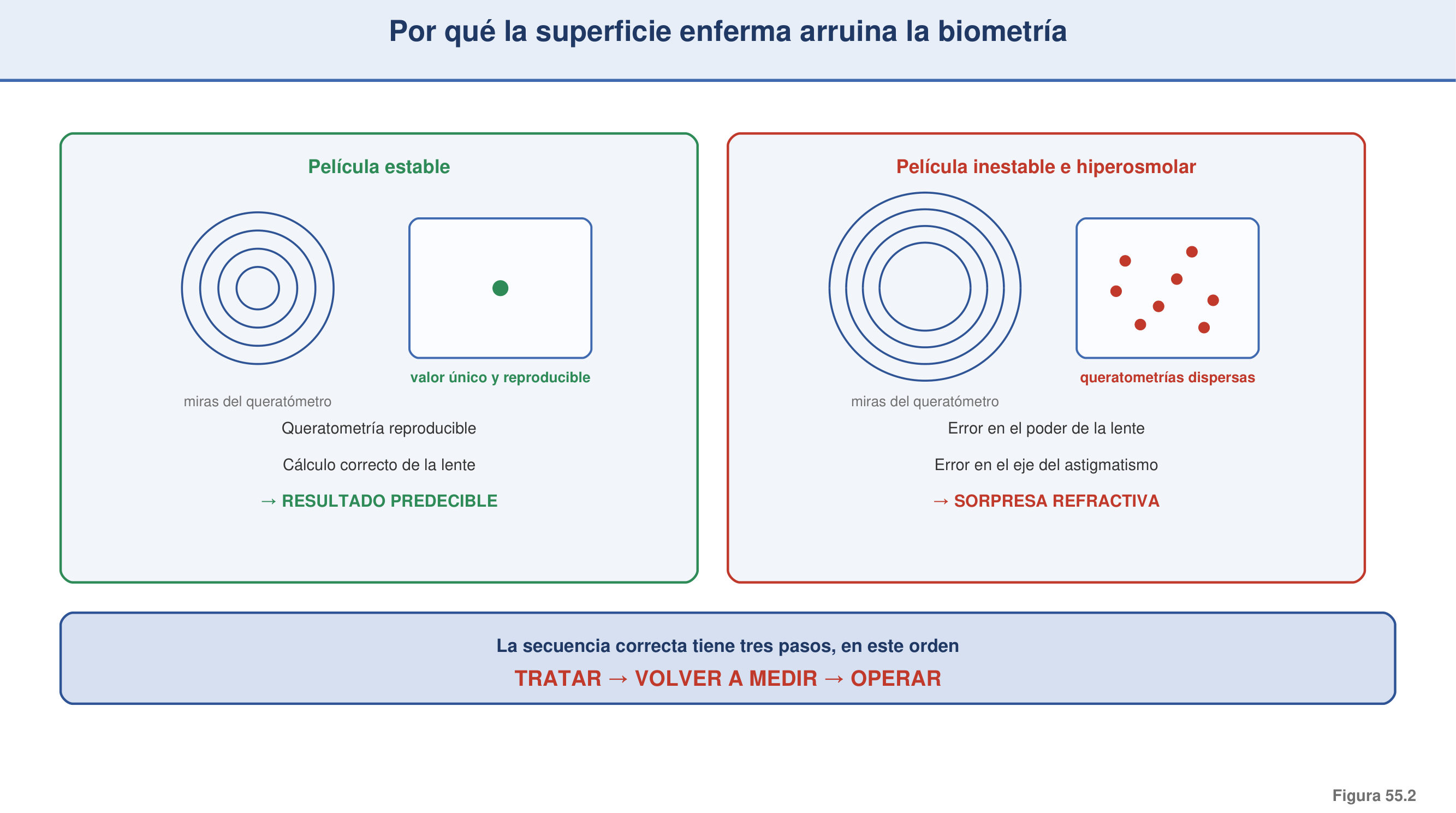 Figura 55.2 — Por qué la superficie enferma arruina la biometría