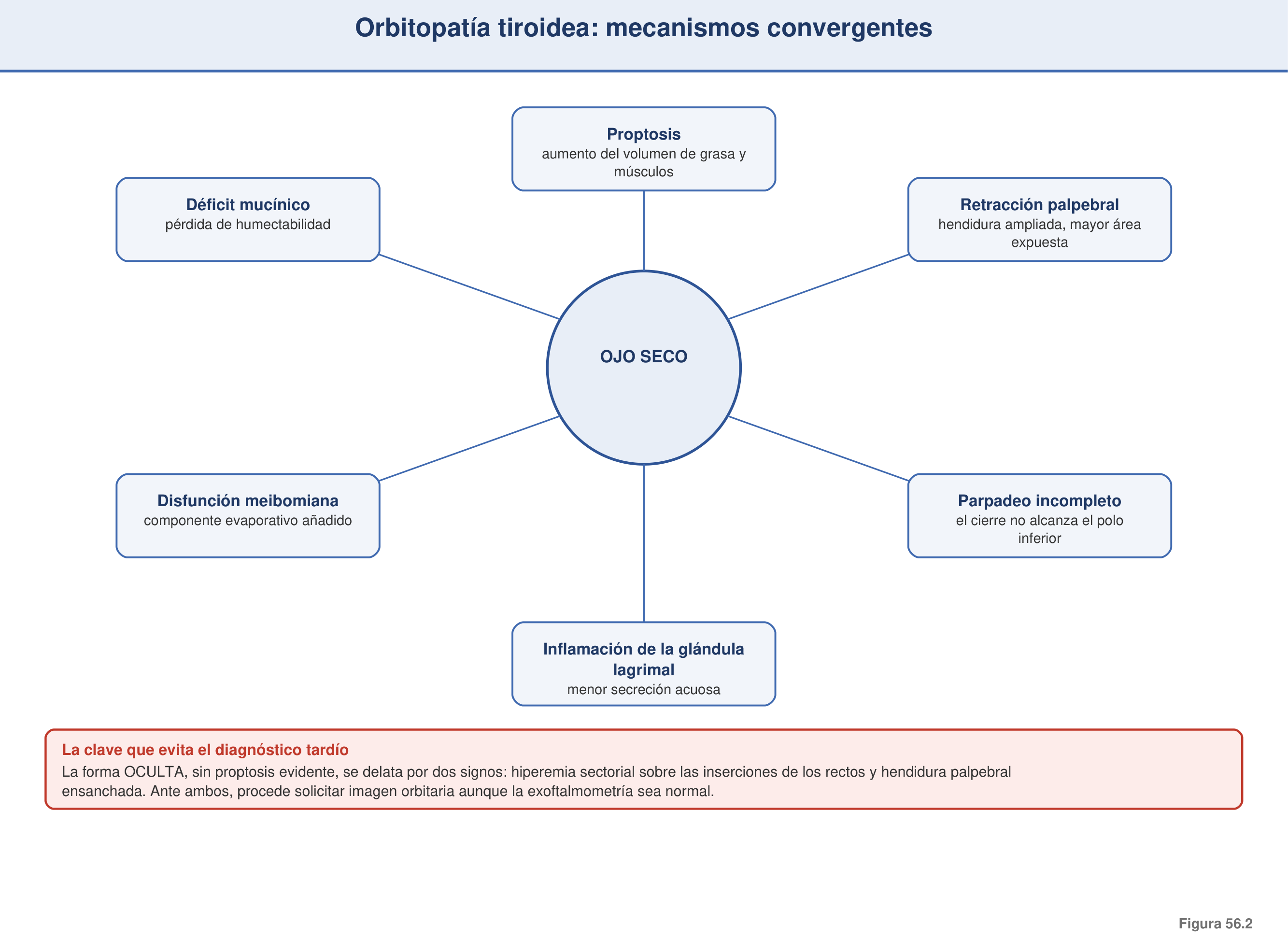 Figura 56.2 — Orbitopatía tiroidea: mecanismos convergentes