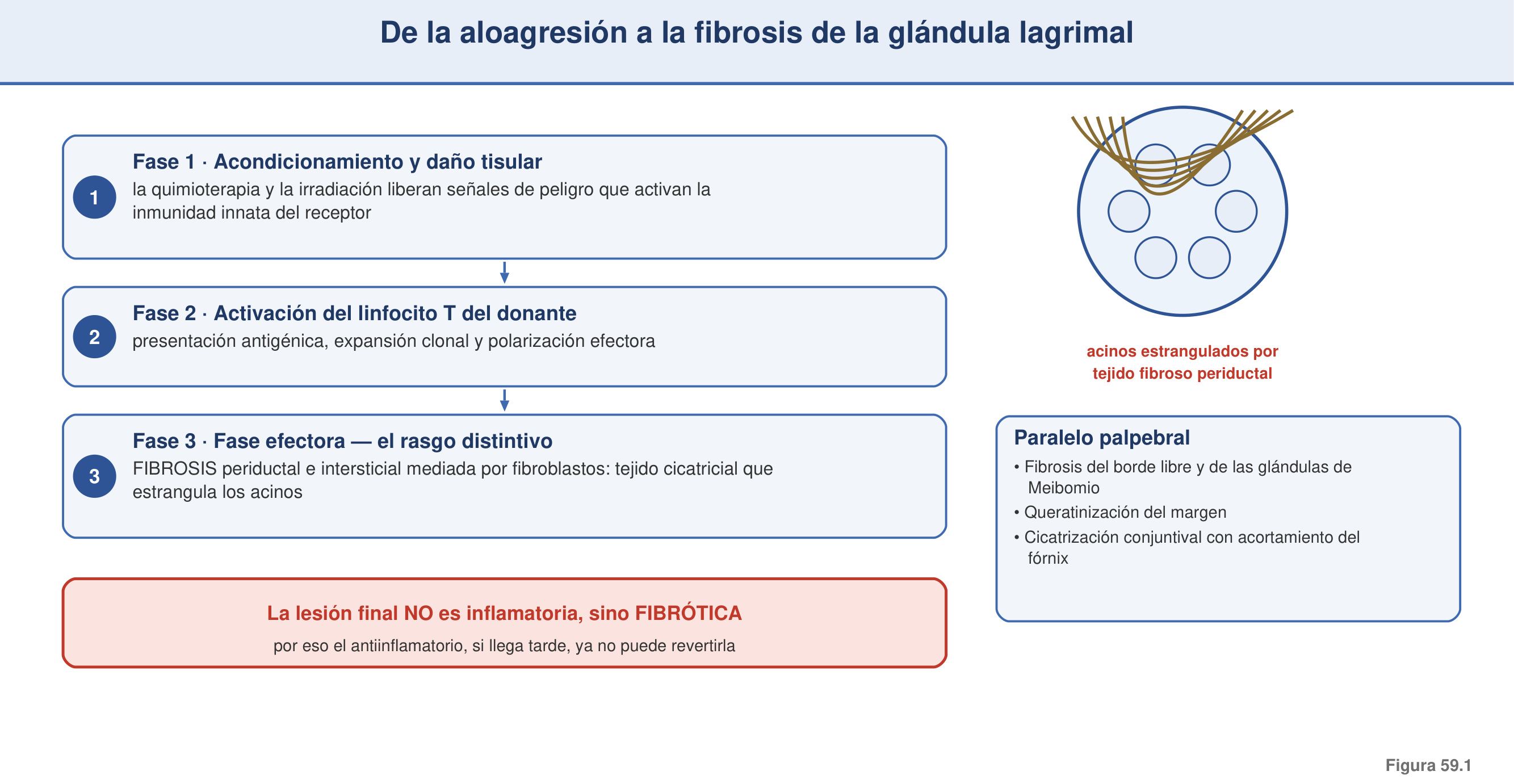 Figura 59.1 — De la aloagresión a la fibrosis de la glándula lagrimal
