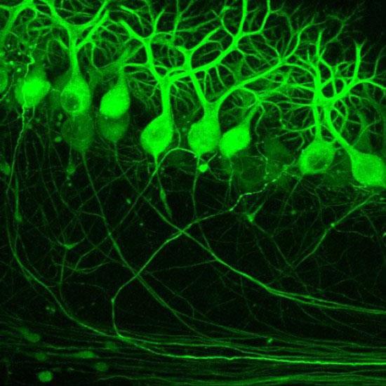 Nerve-cells_6.Neuronal-netw_1