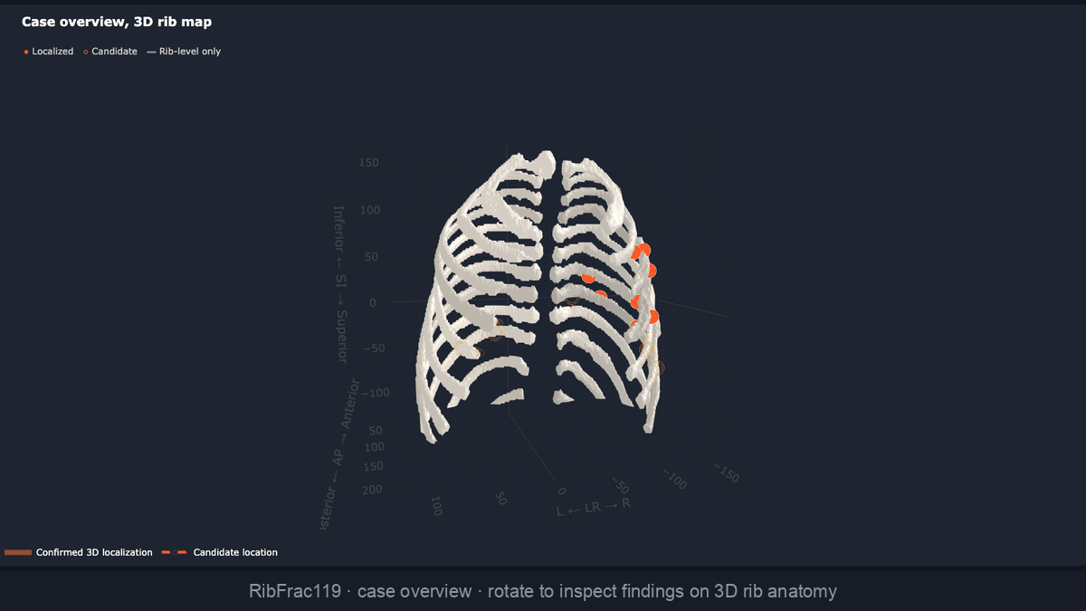 RibAssist 3D clinician-review demo: highlighted fractures, rib-level addressing, and selective 3D localization on interactive rib anatomy, with uncertain findings preserved for review