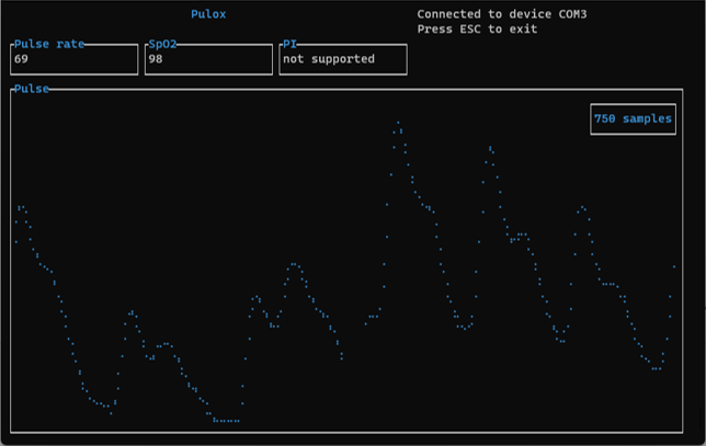 terminal user interface