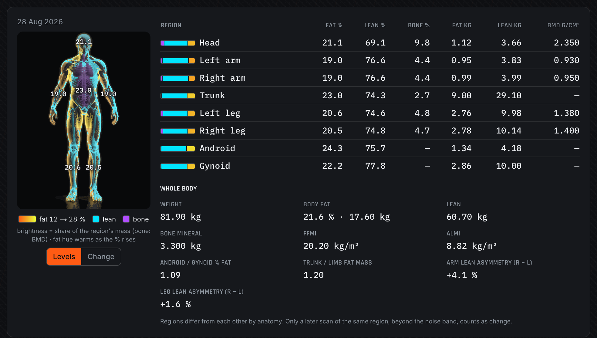 Regional body figure and DEXA region table (demo data)