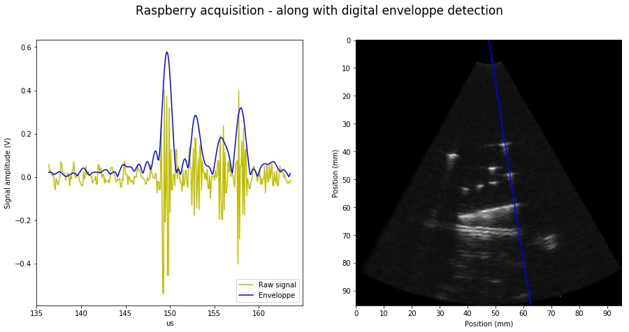 15 Rpi Ultrasound Imaging Platform Hacking Ultrasound - 