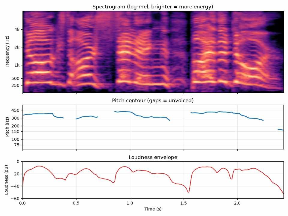 Composite input: log-mel spectrogram, pitch contour and loudness envelope of an angry utterance