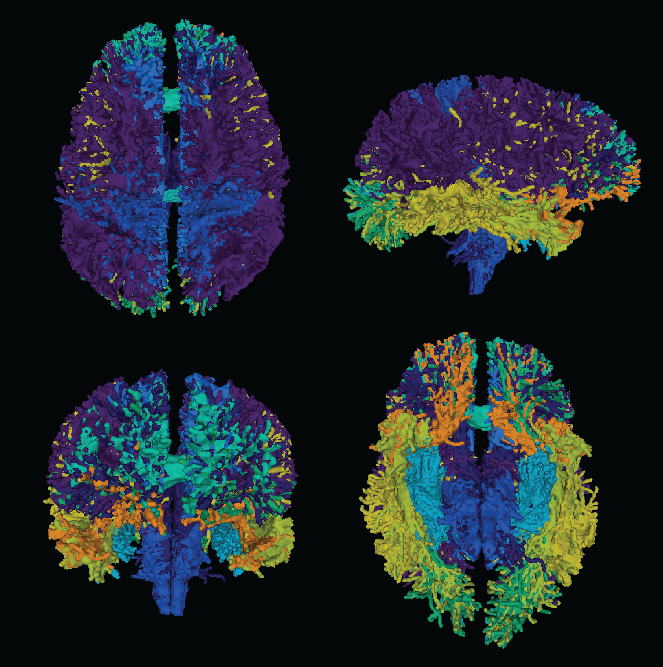 Brainlife