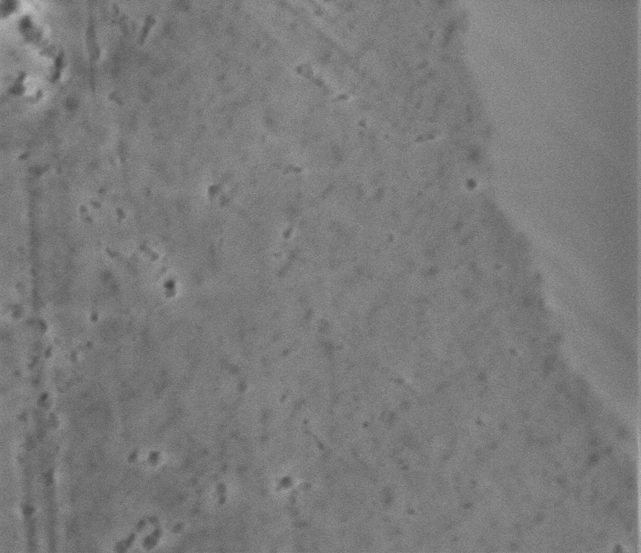 raw SE image of C-S-H (dark grey) and unhydrated alite (light grey)