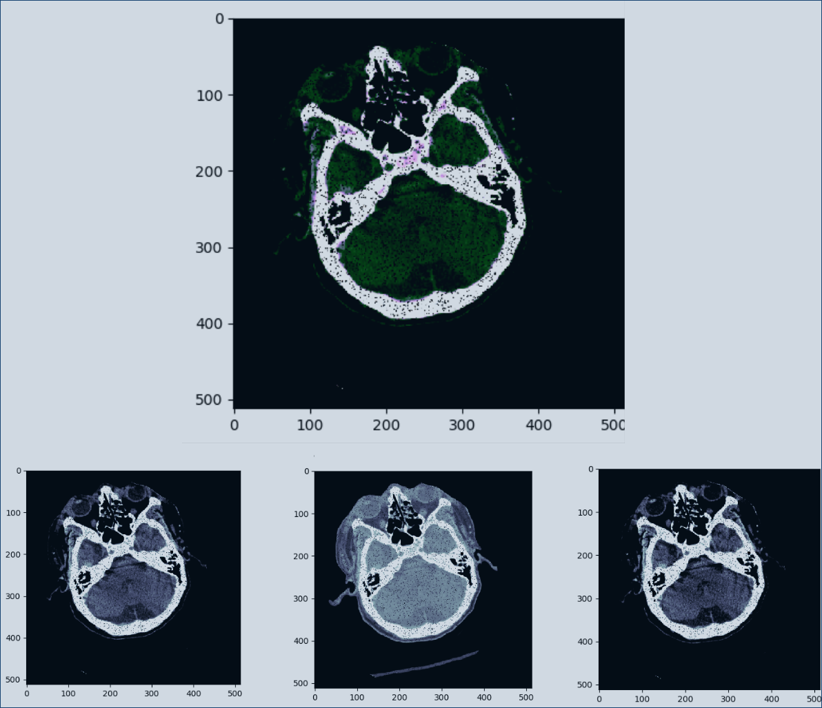 sample_data_augmentation