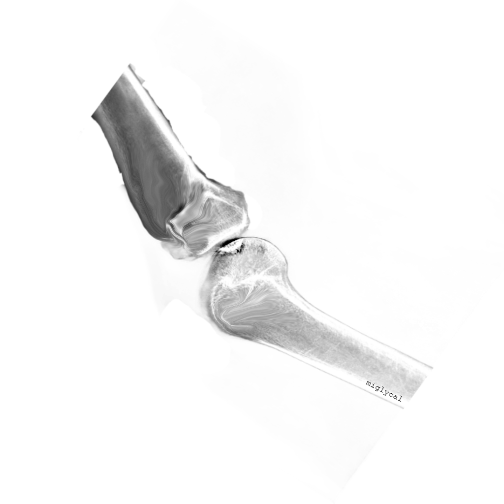 Miglycal logo