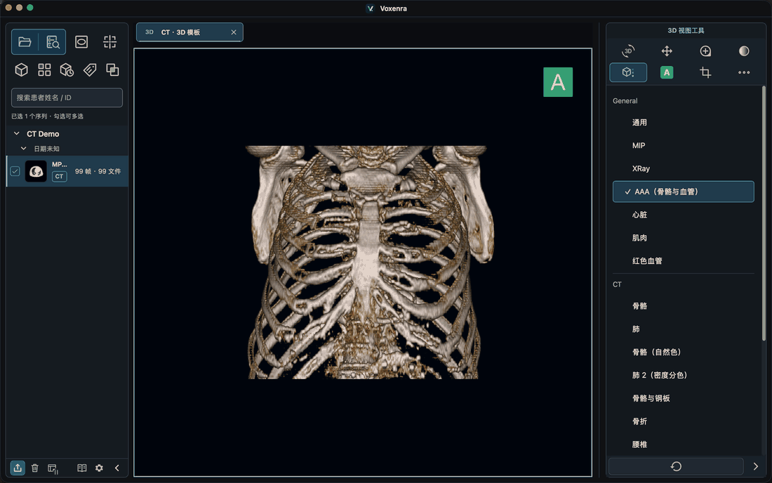 CT 3D 模板切换与旋转
