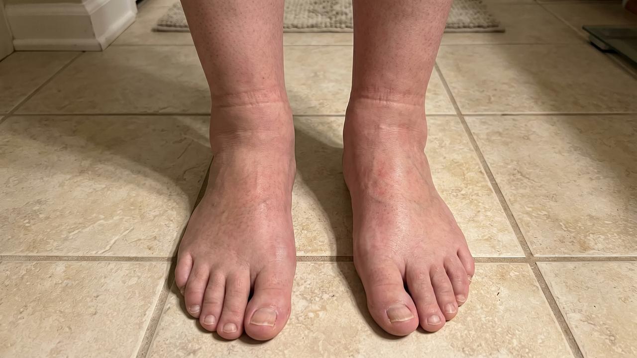 Before and after of swollen ankle vs slim ankle next to the Ornexis EMS Foot Plate