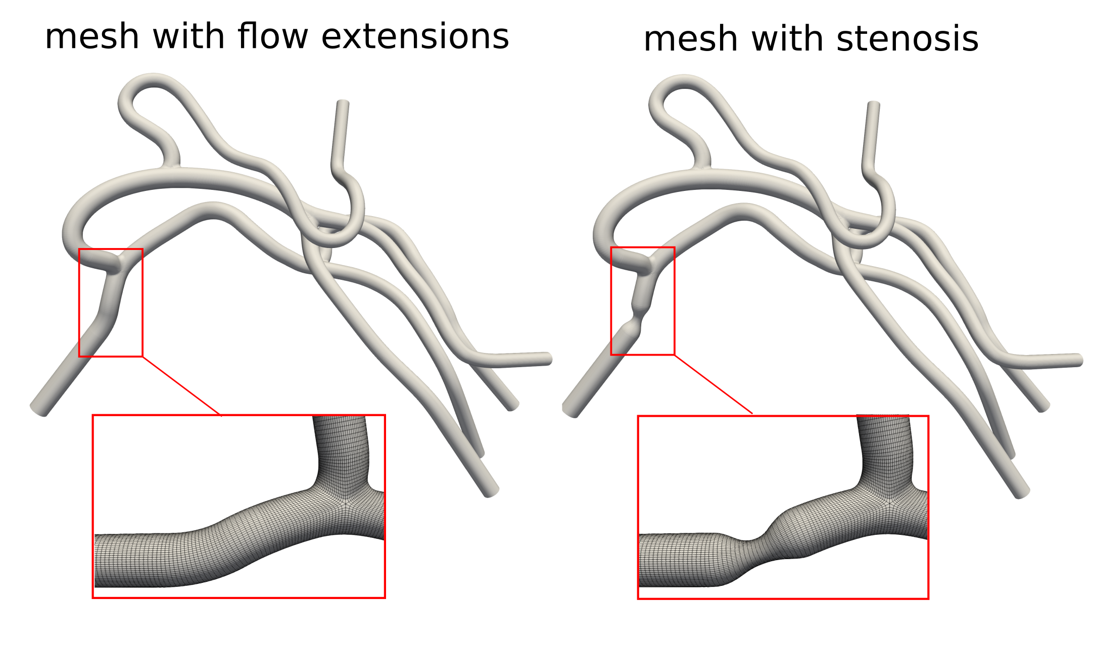 Meshing pipeline