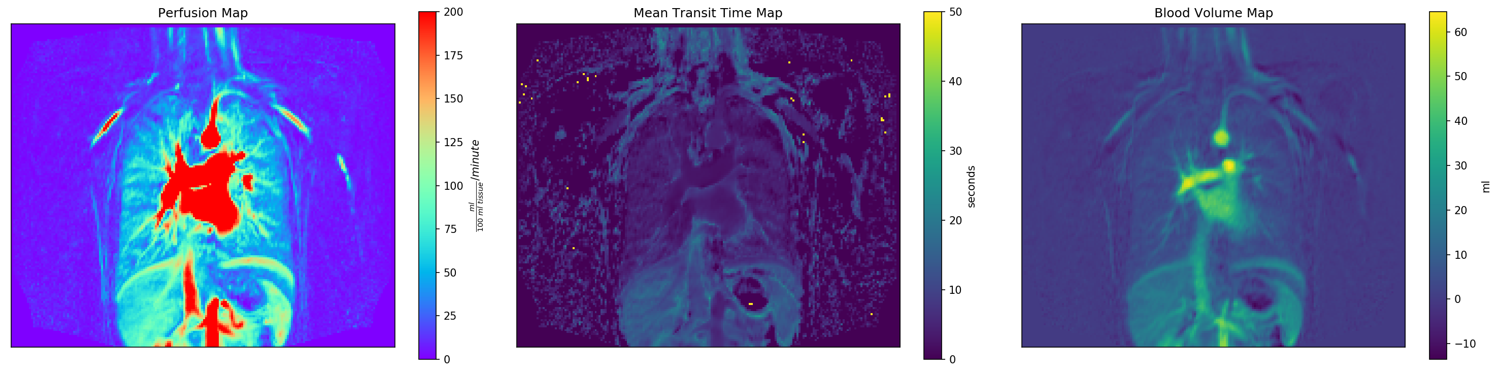 perfusion, mean transit time, and blood volume maps