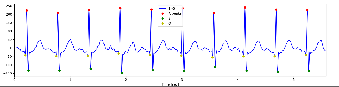 Q,R,S, label in ECG.