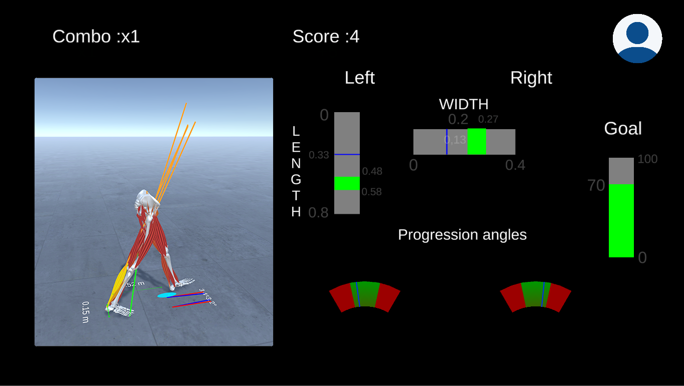 gait_retraining