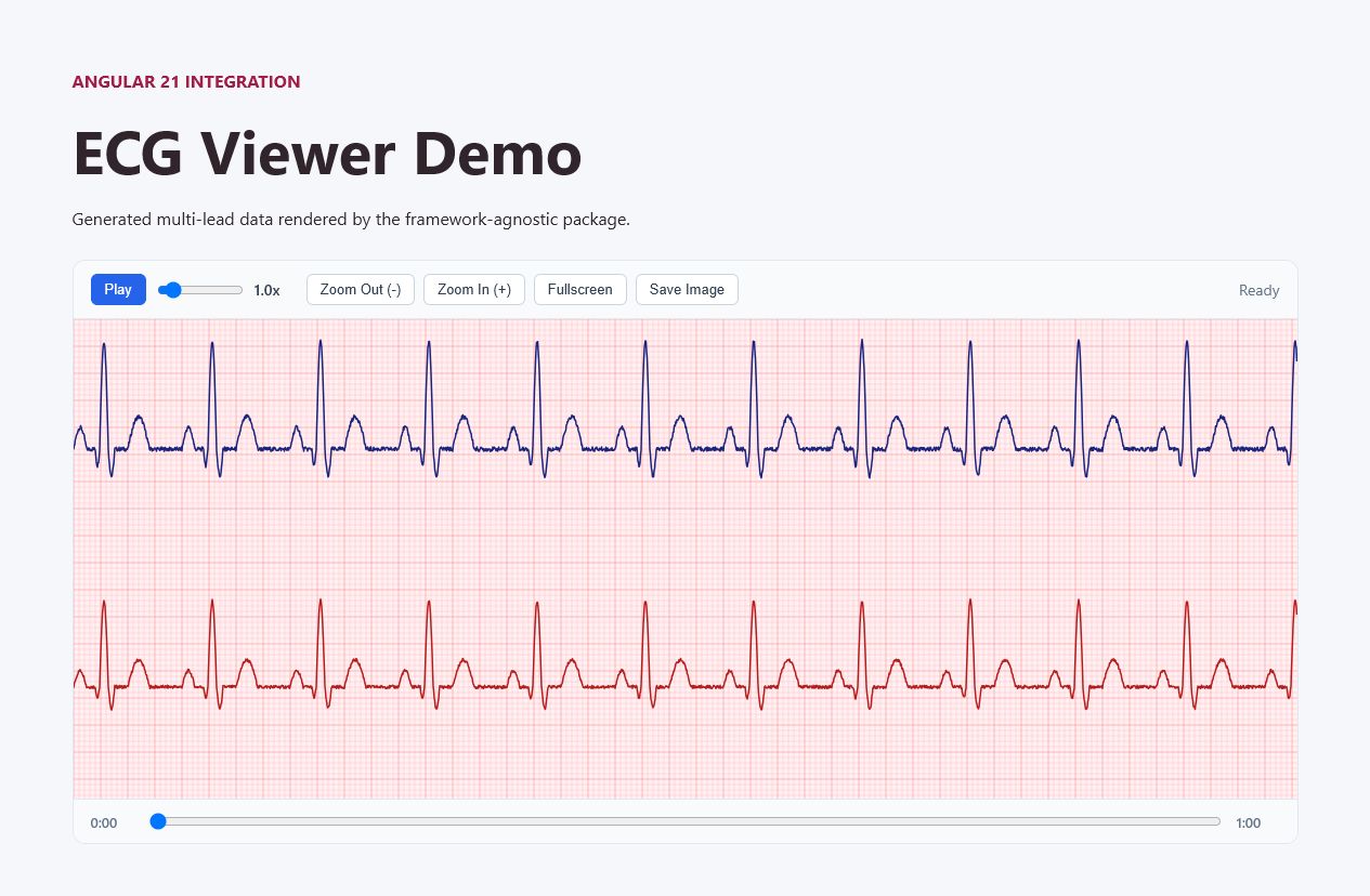 ts-ecg-webviewer Angular demo