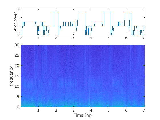 Hypnogram and EMD spectrogram