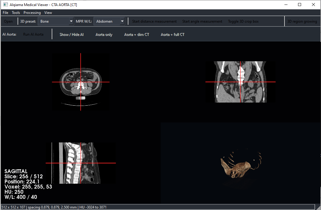 Medical imaging workstation overview with synchronized MPR and 3D CT visualization