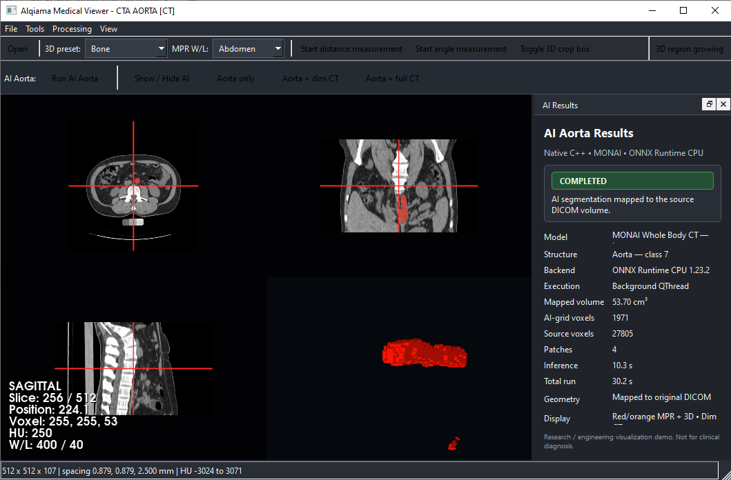 Aorta-only 3D AI surface