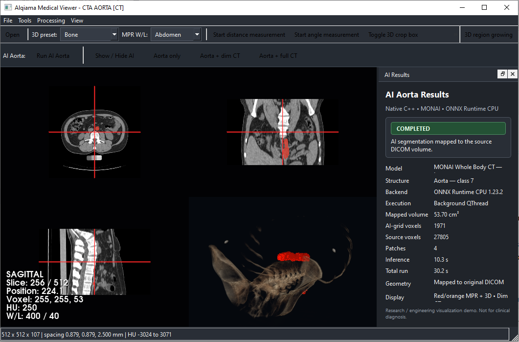Aorta segmentation shown with dimmed CT context