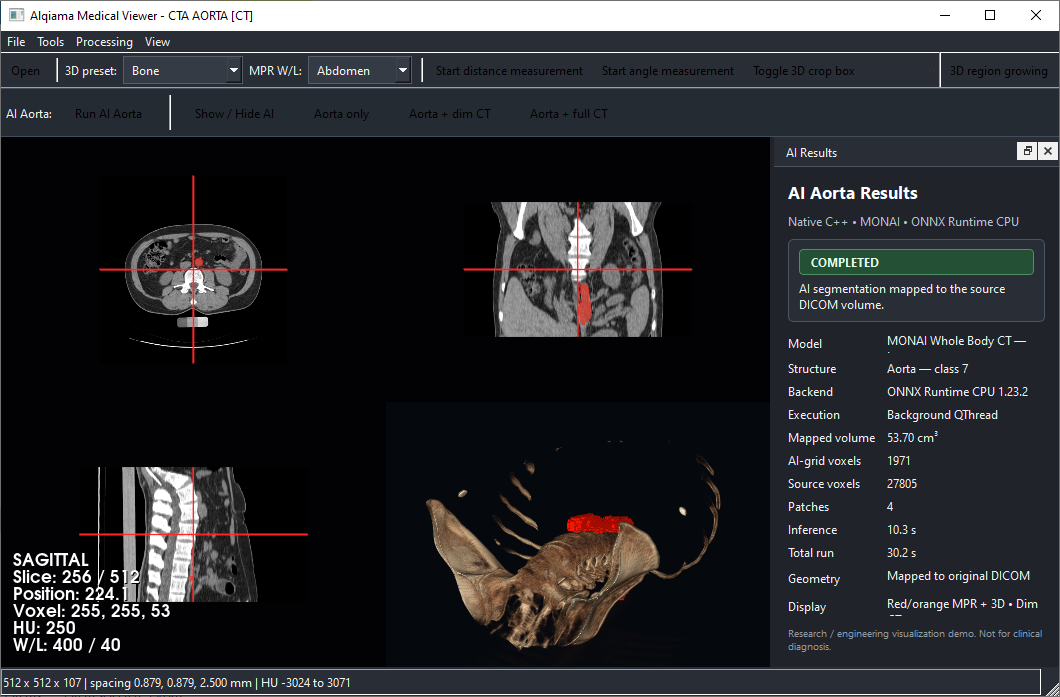 Aorta AI surface with full CT context