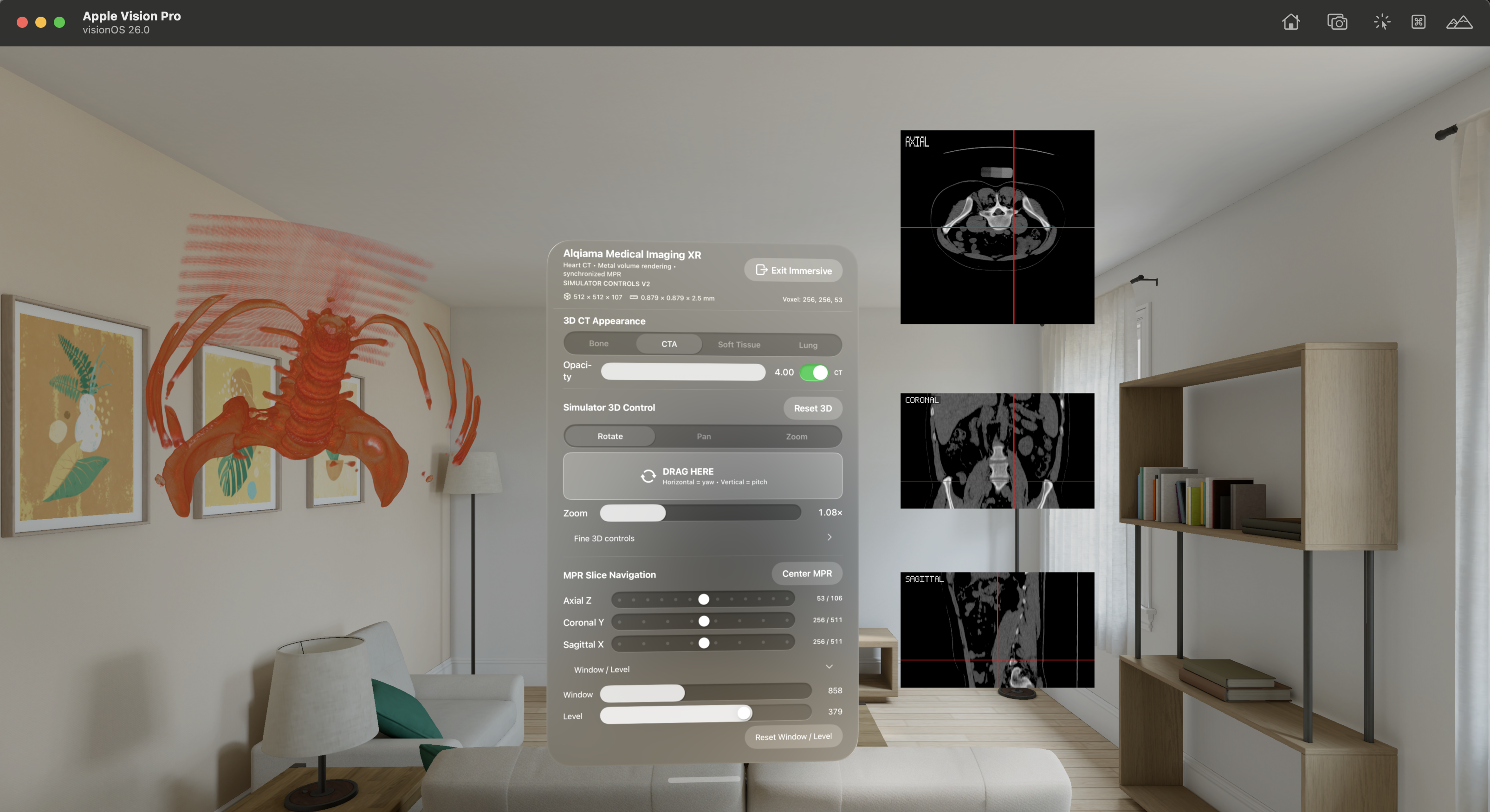 Apple Vision Pro CTA volume rendering screenshot