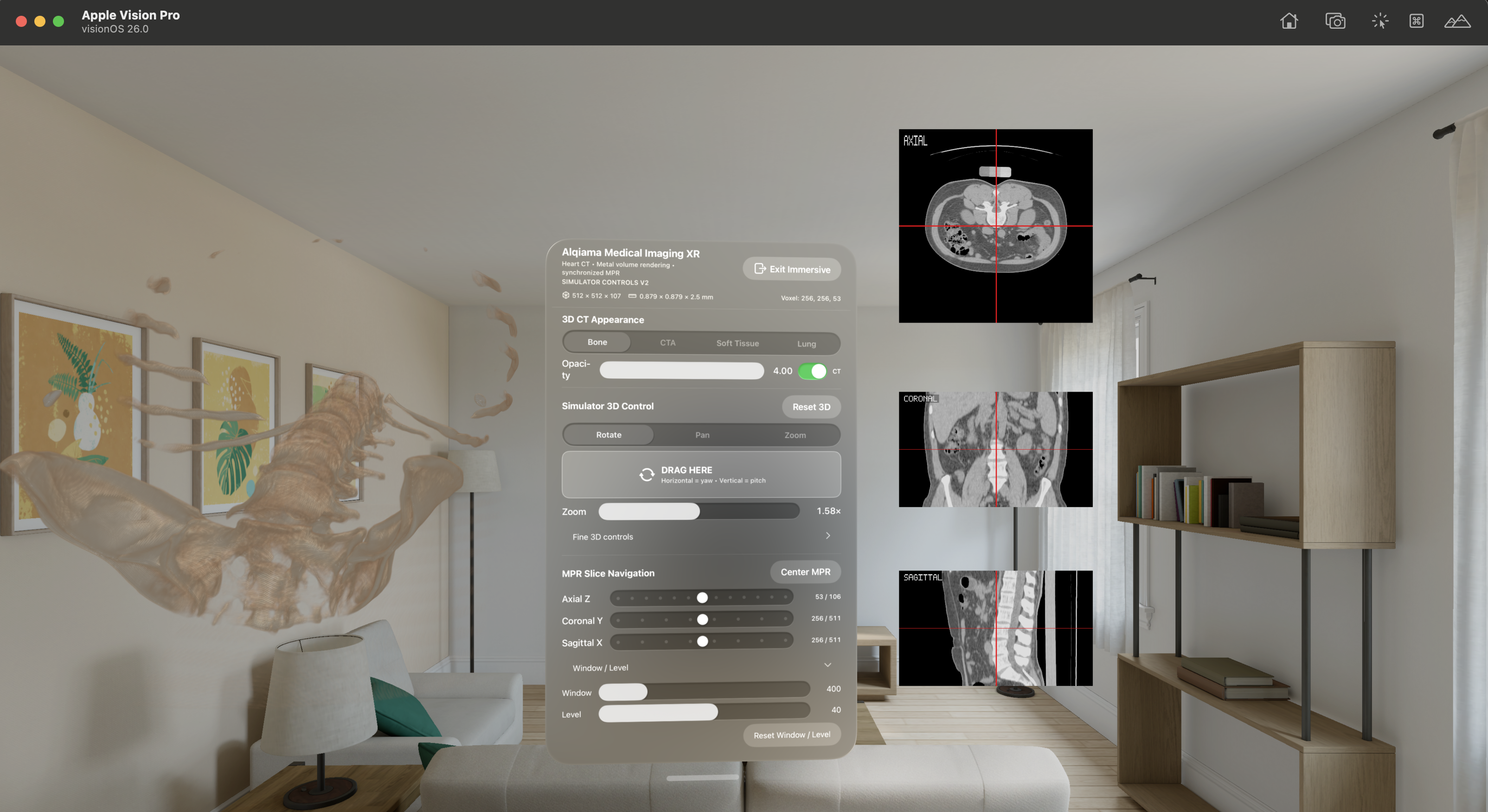 Apple Vision Pro Bone volume rendering screenshot