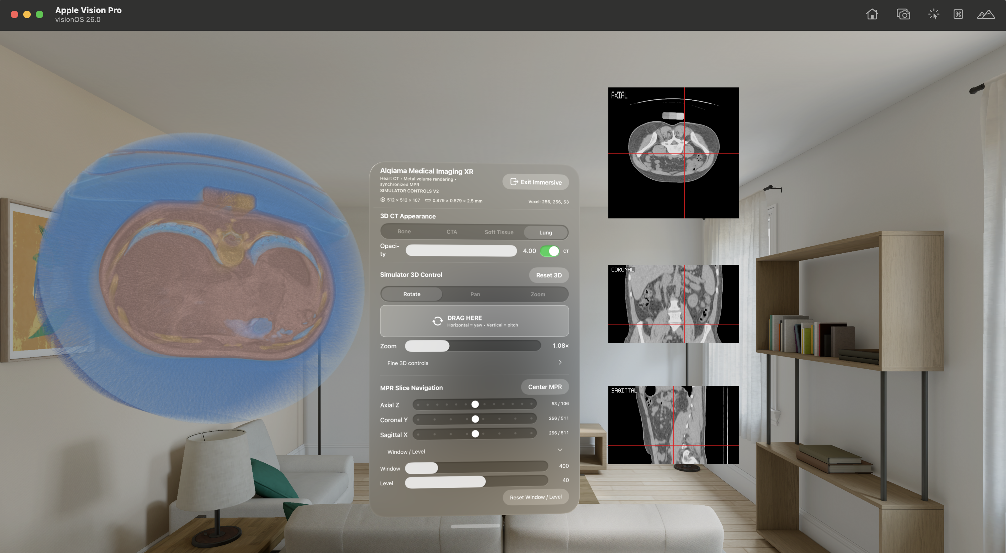 Apple Vision Pro Lung volume rendering screenshot