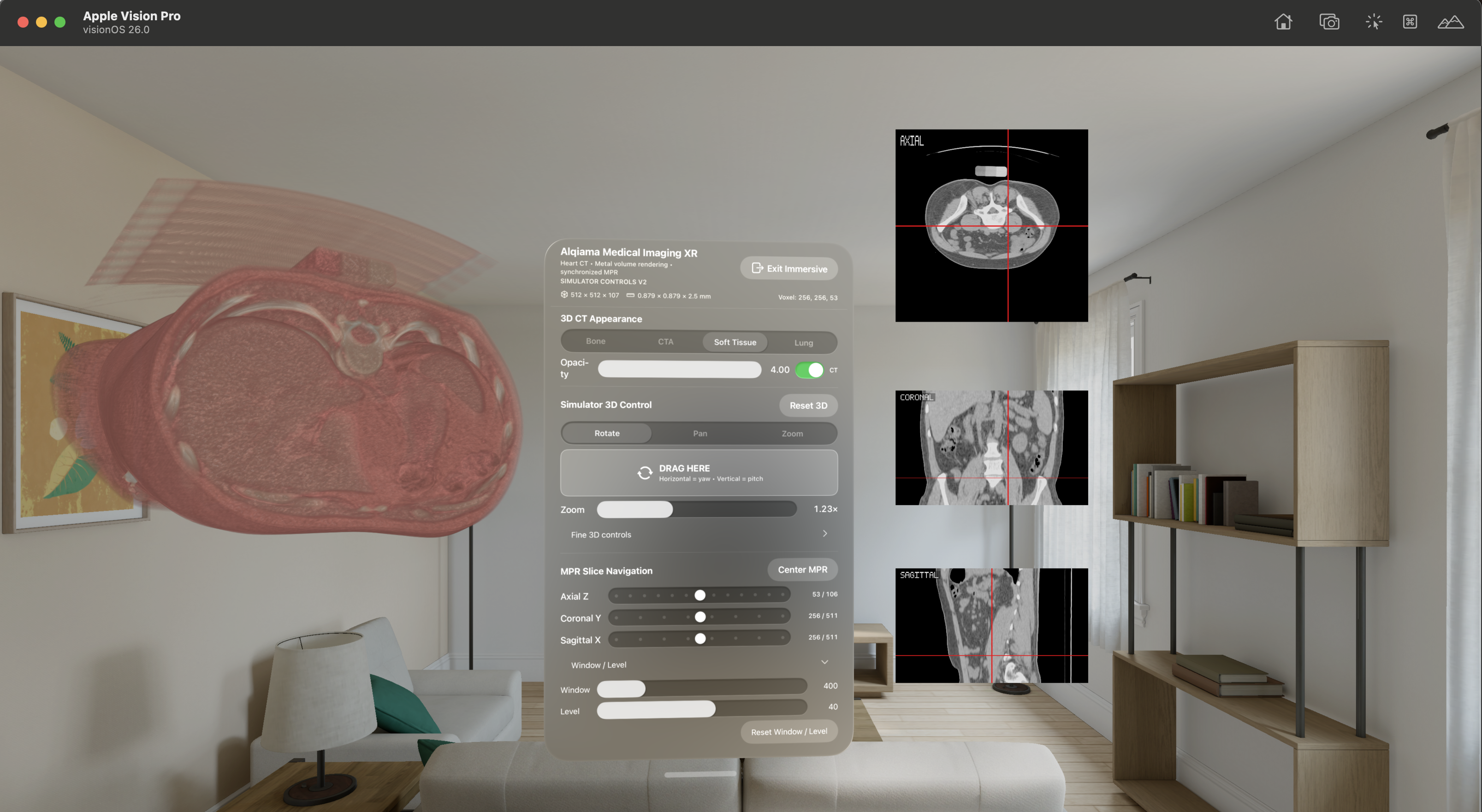 Apple Vision Pro Soft Tissue volume rendering screenshot