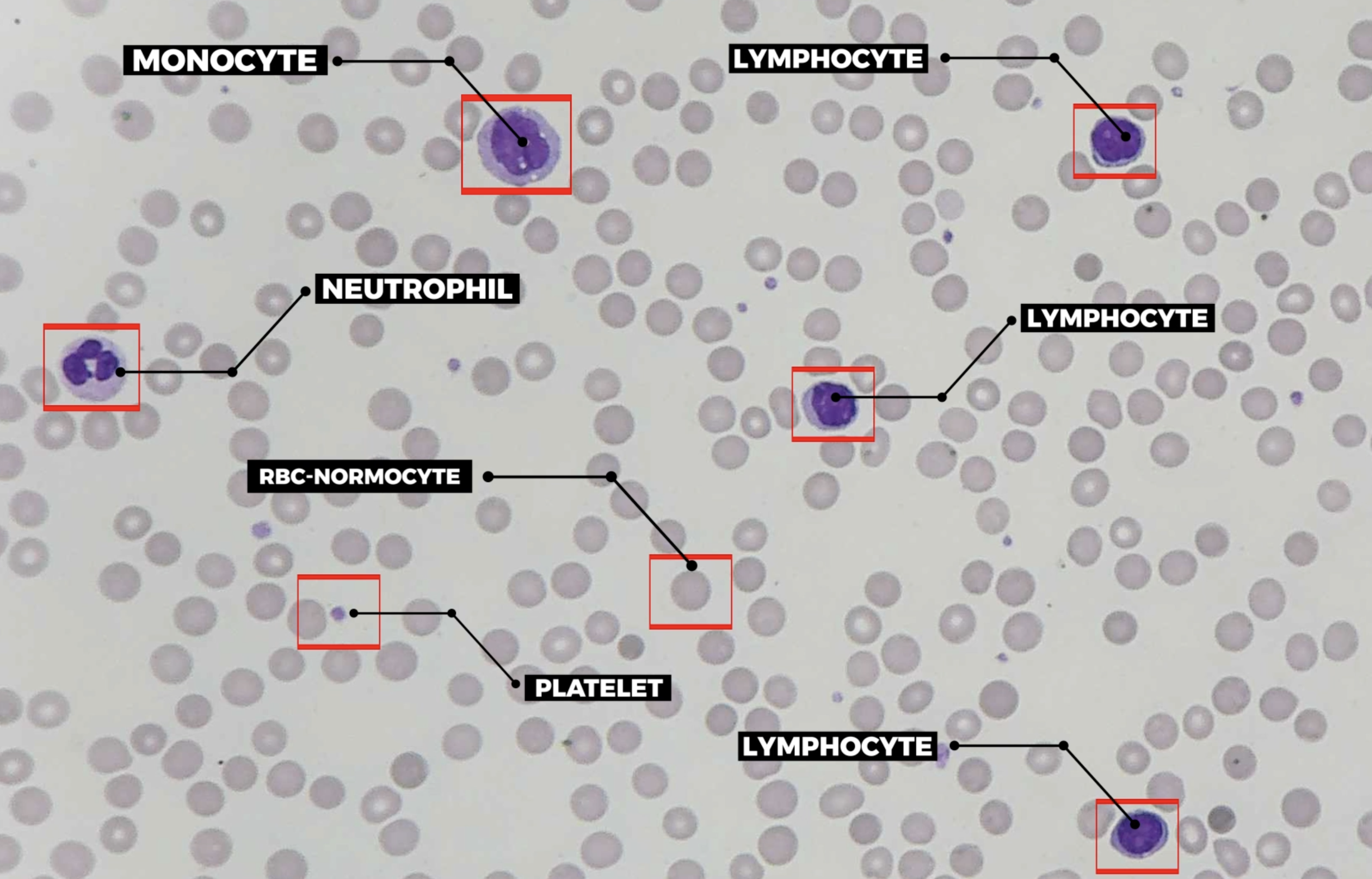 Automated cell identification — placeholder, replace with GIF