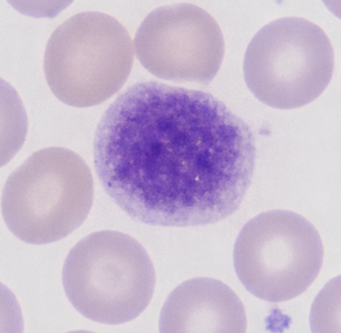 Platelets
