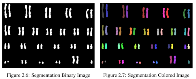 Chromosomes segmentation