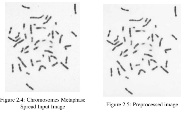 Image preprocessing