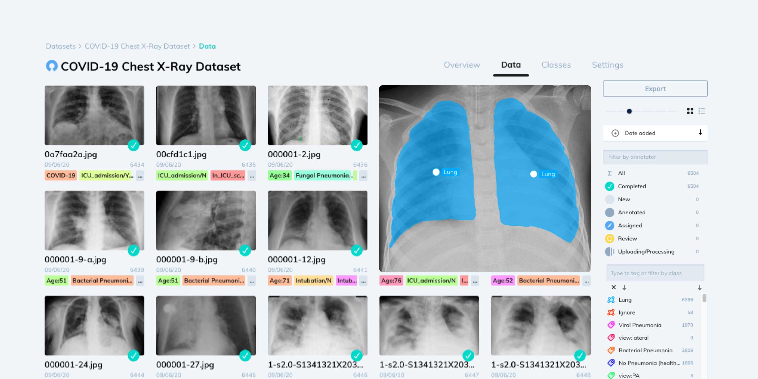 media/covid-chest-xray-cover.jpg