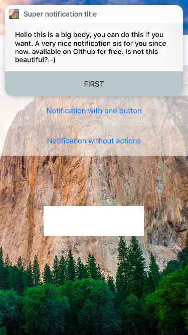 Notification with button actions