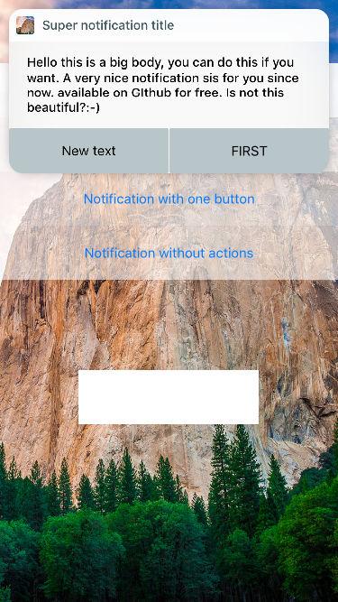 Notification with button actions